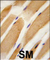 Actin (ACTB/ACTC) Antibody (Center)